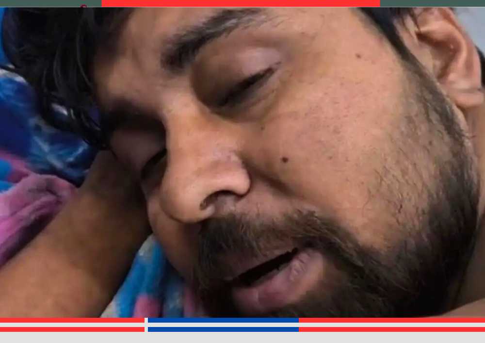 जौनपुर में साली द्वारा जलाए जाने के बाद अस्पताल में भर्ती झुलसा हुआ युवक।